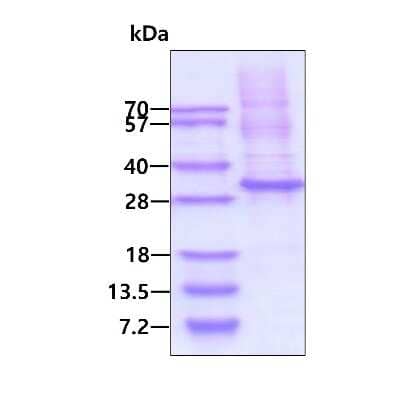 SDS-PAGE: Recombinant Human Granzyme K His Protein [NBP2-23087]